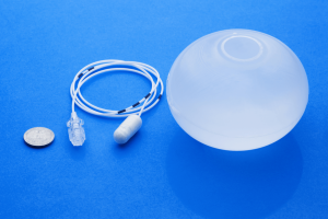 The-Elipse-Balloon-A-new-gastric-Balloon-with-Interesting-Features